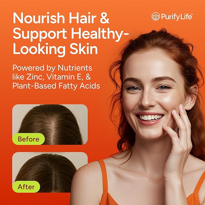 Sugar-Free Pumpkin Seed Oil Gummies (4,000mg/serving) Pumpkin Seed Oil for Hair Growth, Youthful Skin, Prostate Health, Immune & Urinary Tract Support-Natural Source of Essential Fatty Acids-60 Chews-SeraviaPure